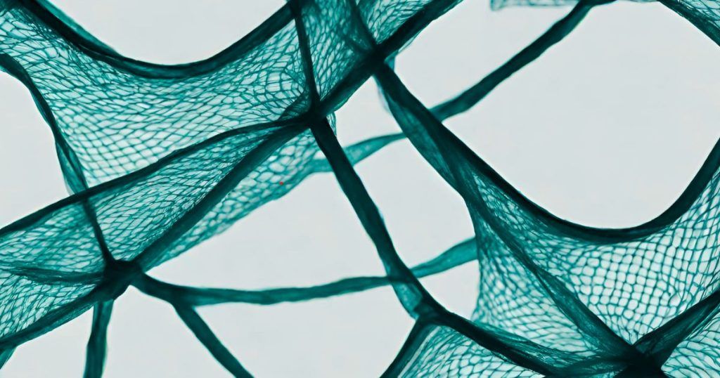 Netting vs. Other Treasury Strategies A Comparative Analysis FTI